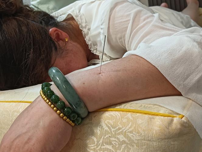 宫颈息肉的针灸治疗