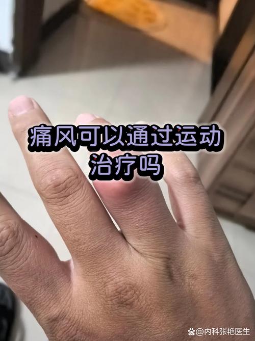 痛风病人能不能游泳