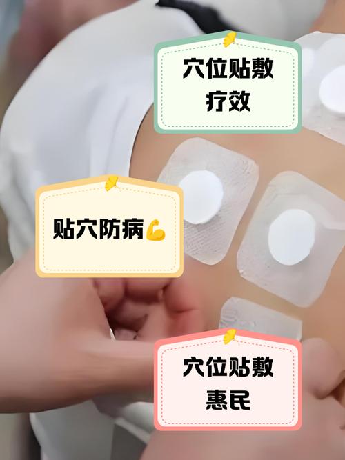 贴针灸怎样找到穴位