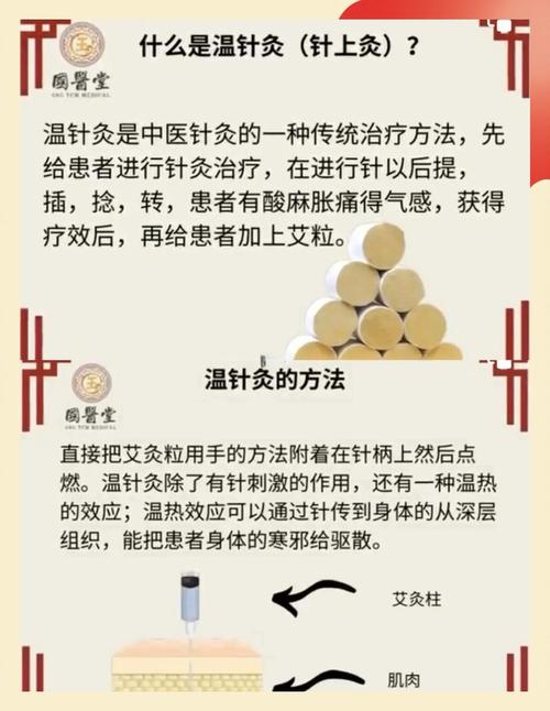 针灸肚子有什么作用