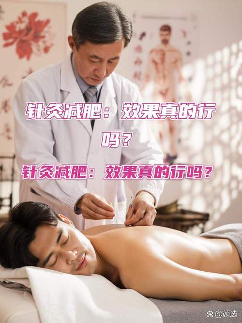 洛阳针灸减肥哪里好