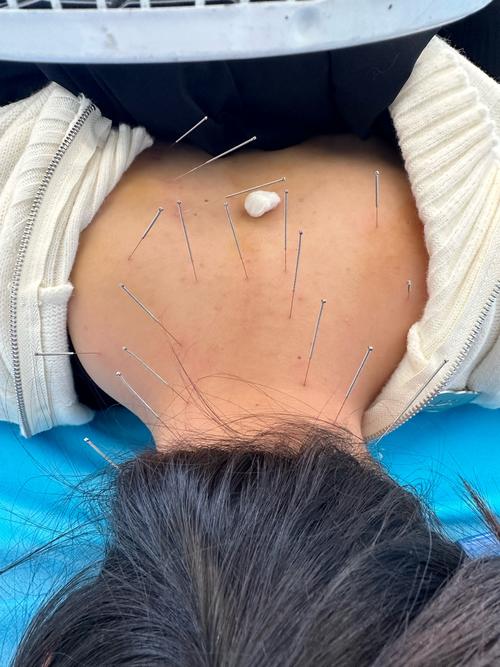 沈阳有名的中医针灸