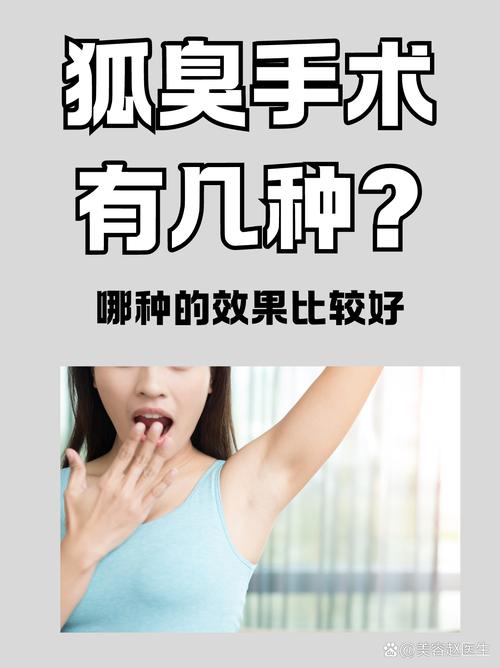 广州狐臭手术协佳安全