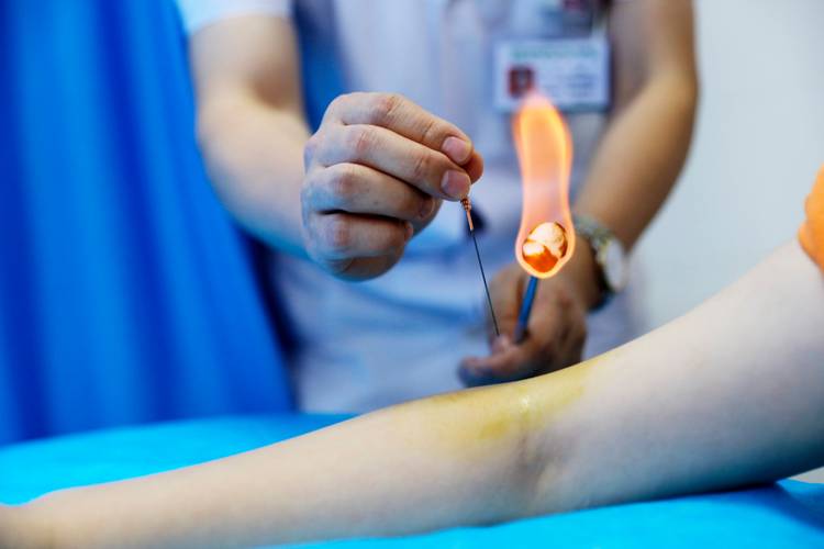 针灸推拿本科找工作