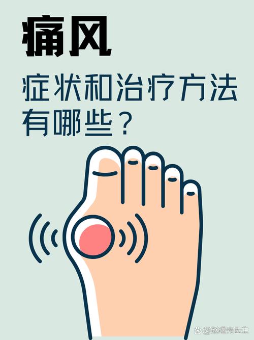 青岛人如何治疗痛风