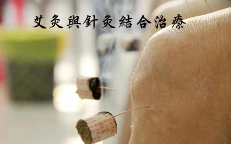 温州哪个医院针灸好