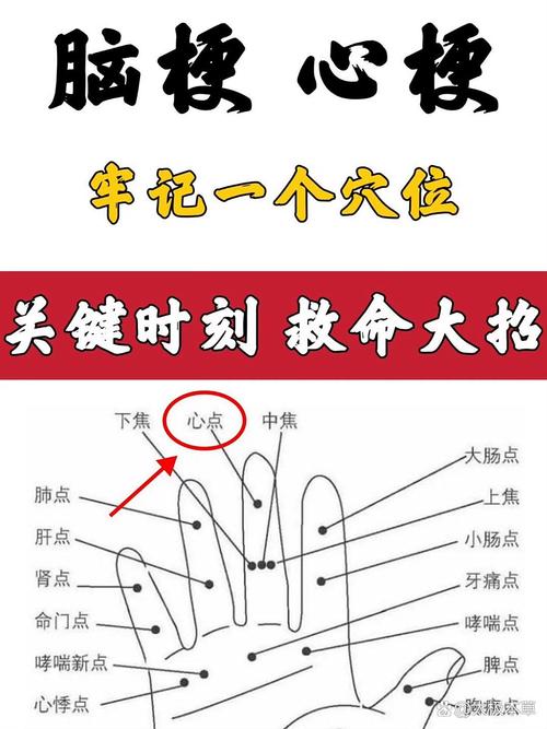 脑血栓针灸治疗穴位