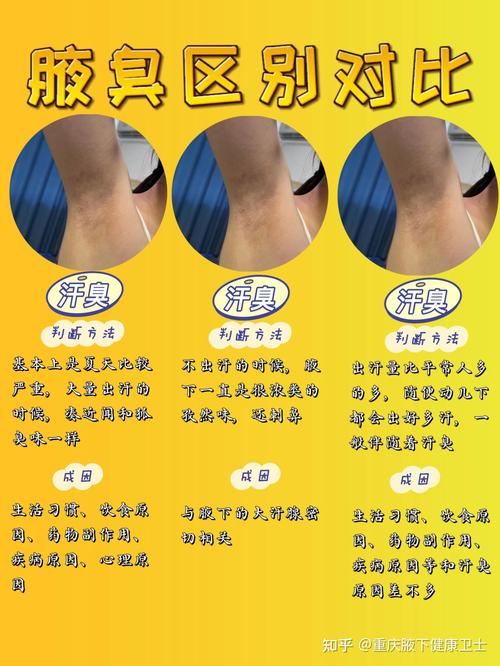 重庆看狐臭三一八安全