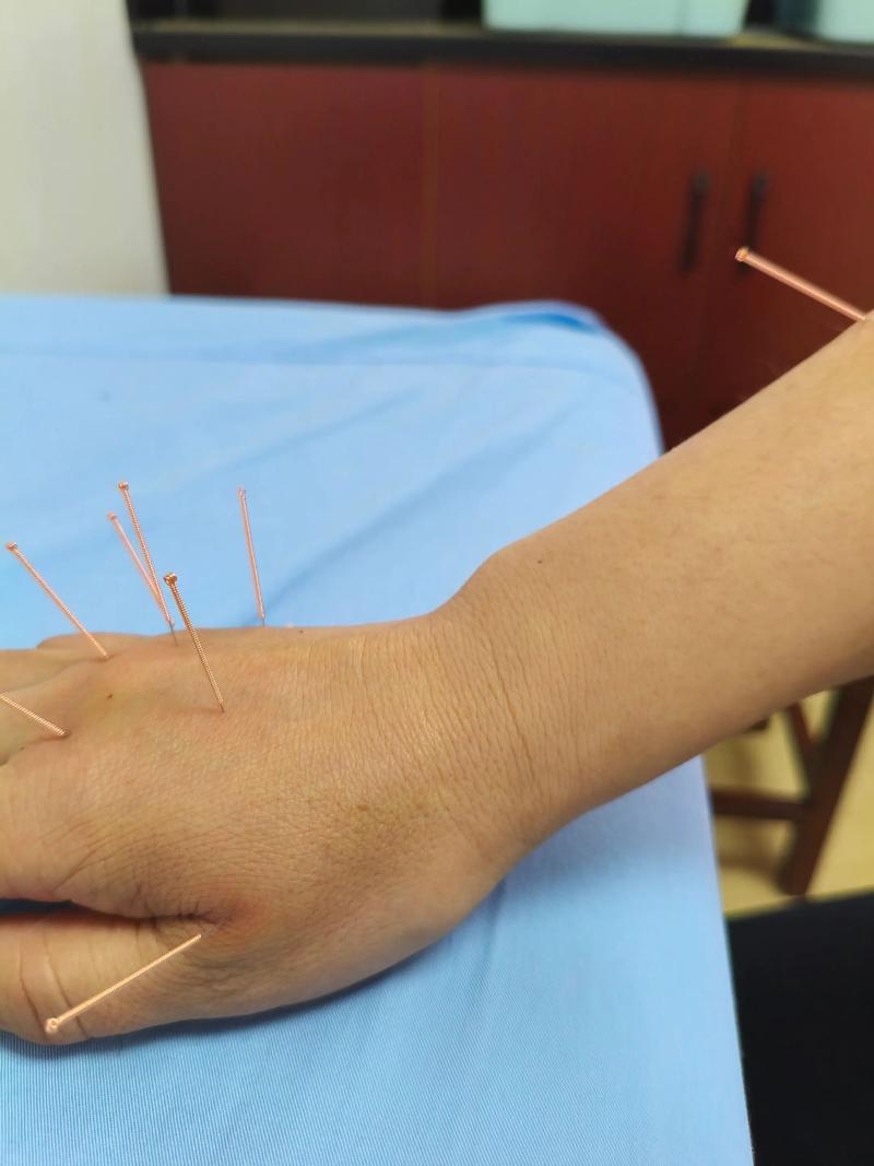 深圳哪里可以学针灸