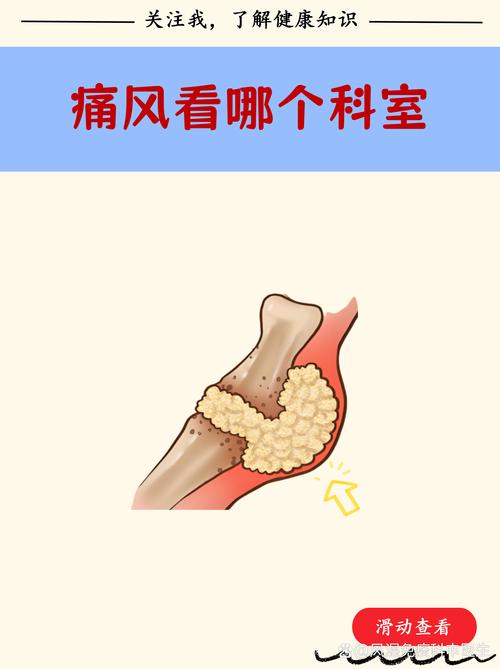 痛风中医看什么科室