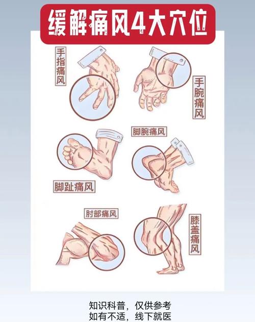 老龄人痛风如何治疗