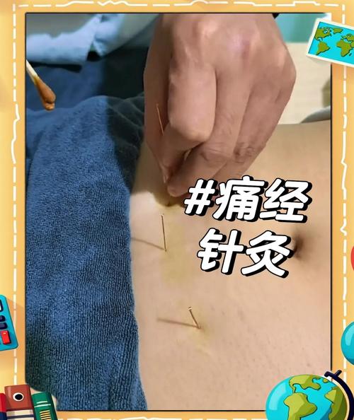 月经不来针灸管用吗