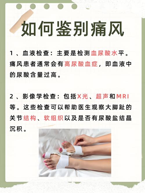 痛风为什么会那么痛