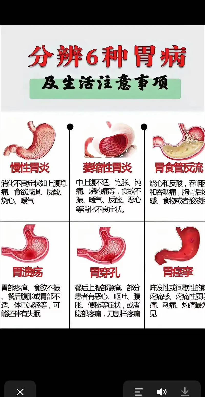 胃病针灸好还是中药