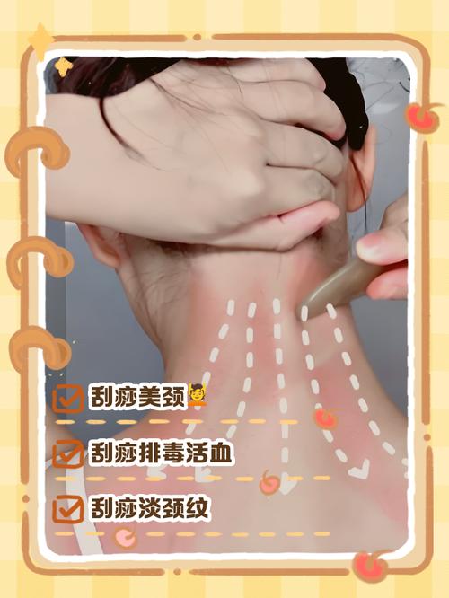 刮痧和针灸哪个减肥