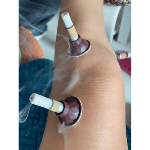 关节腔积液针灸治疗