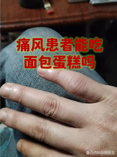 痛风早饭吃什么最好