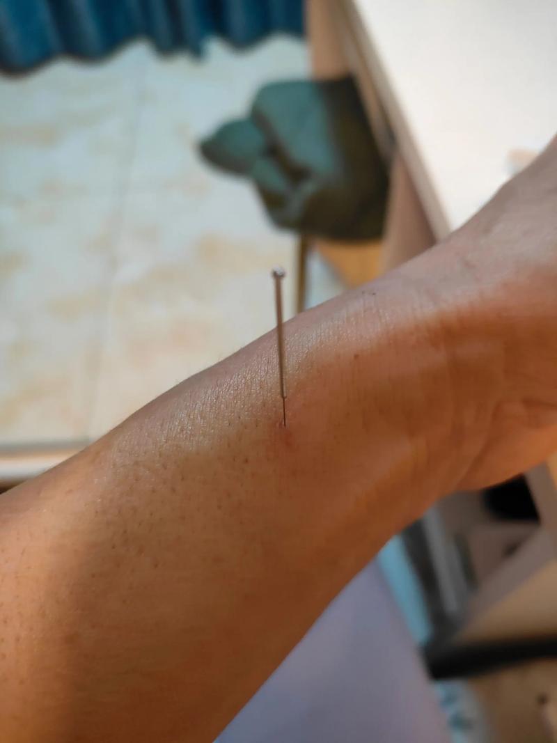 天突可以针灸的深度