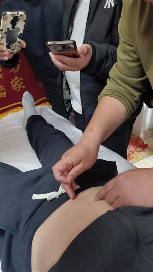 遗尿的针灸治疗视频