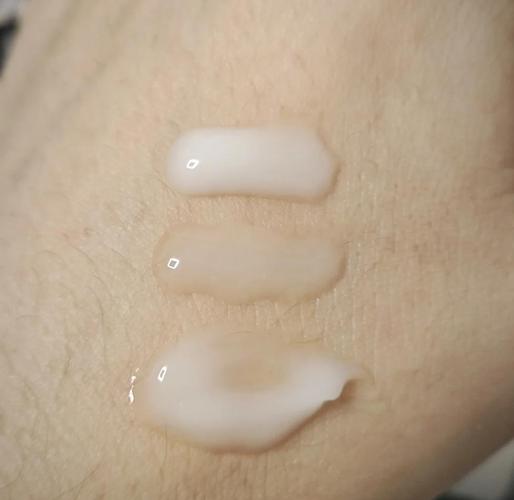 痛风可否使用扶他林