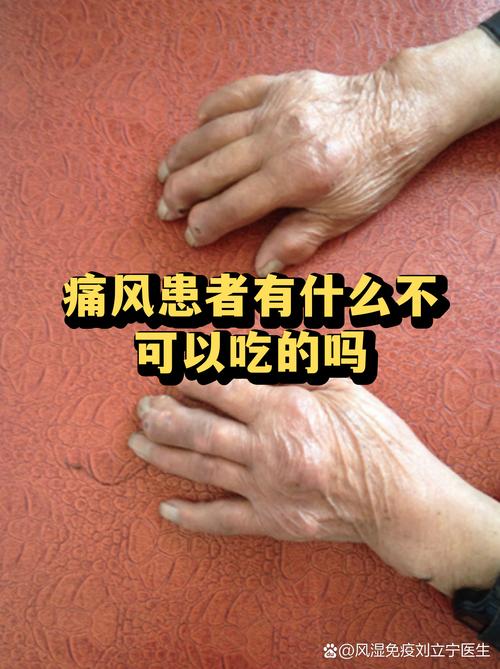 痛风可以吃人工菌吗