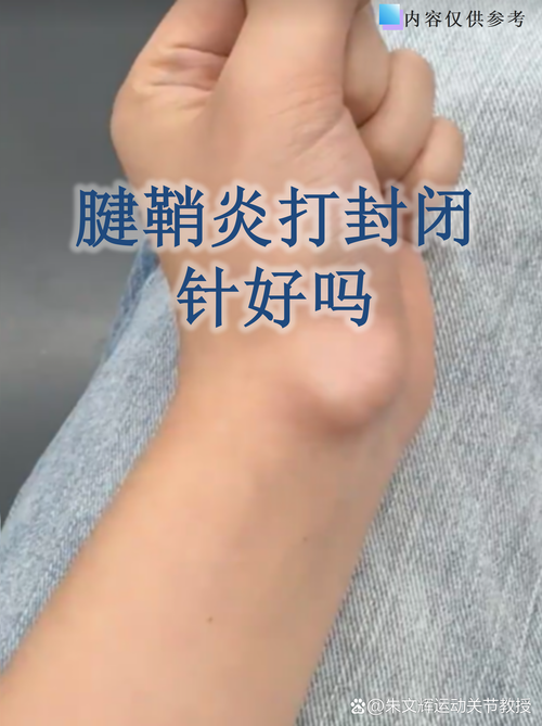 肌腱损伤可以针灸吗