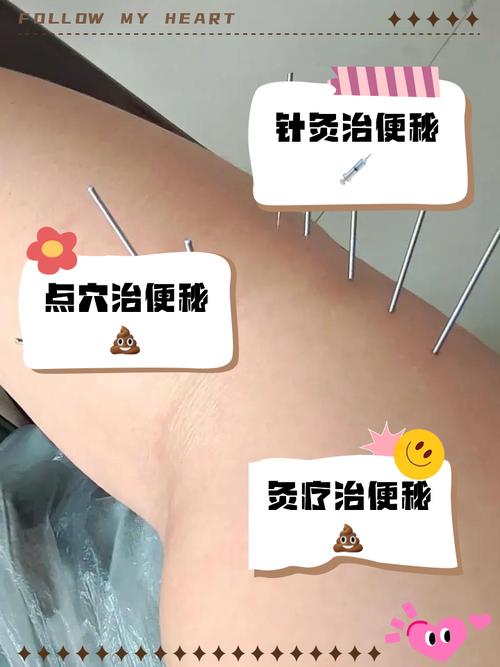 婴儿便秘可以针灸吗