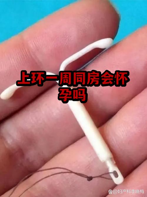 上环一个月同房安全吗