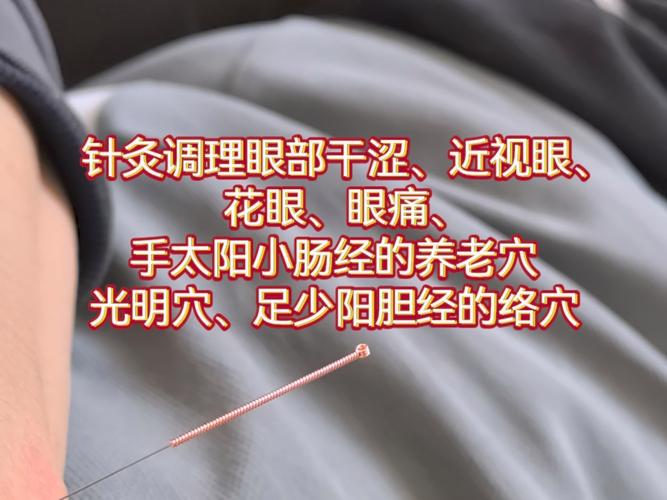 针灸治疗近视的方法