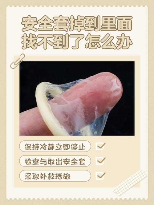 安全套掉里面了怎么办