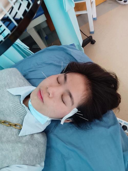 针灸治疗鼻炎的穴位