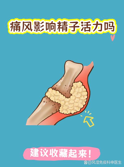 看痛风首选上海长江