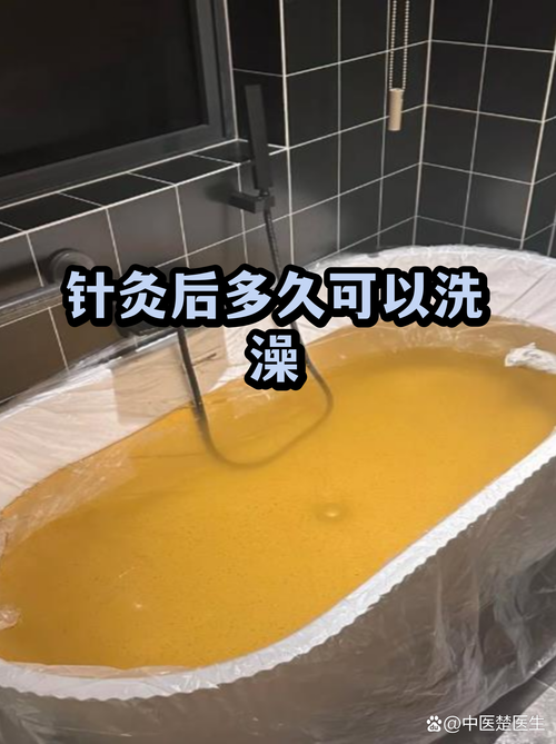 流产后多久可以针灸