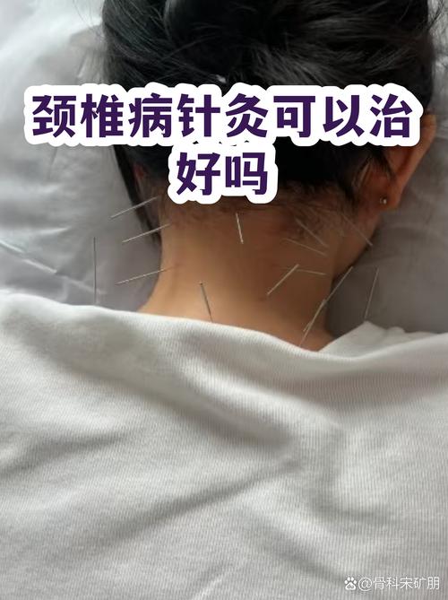 颈椎不好扎针灸好吗
