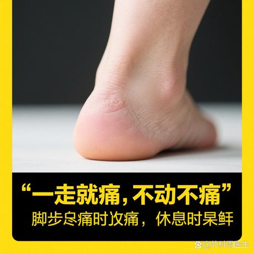 后脚跟疼是不是痛风