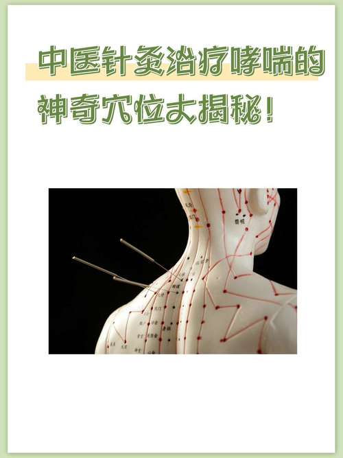 抽搐的针灸治疗方法