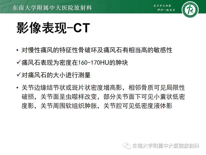 痛风石ct能拍到吗