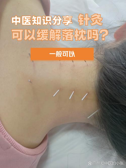 颈椎错位针灸管用吗