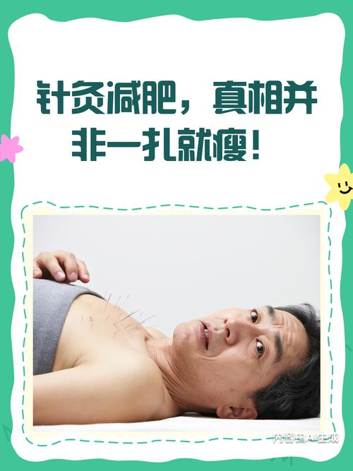 针灸减肥和运动减肥