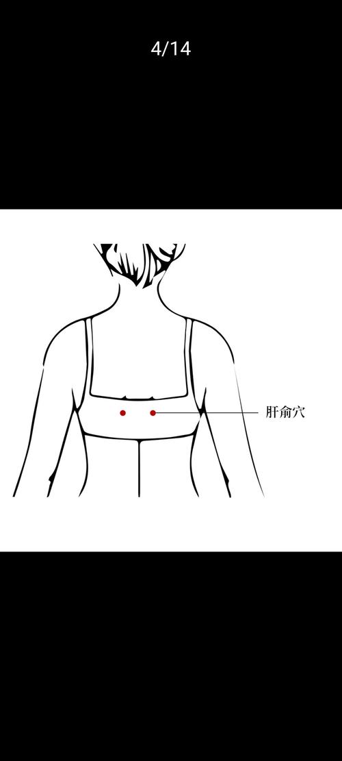 肝火旺针灸什么穴位