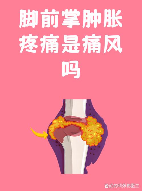 温州杨书生看痛风吗