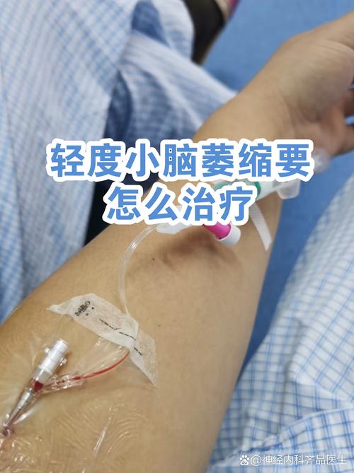 针灸治疗脑萎缩方案