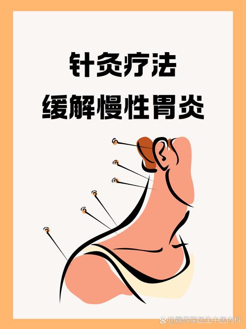 针灸治疗胃病有效吗