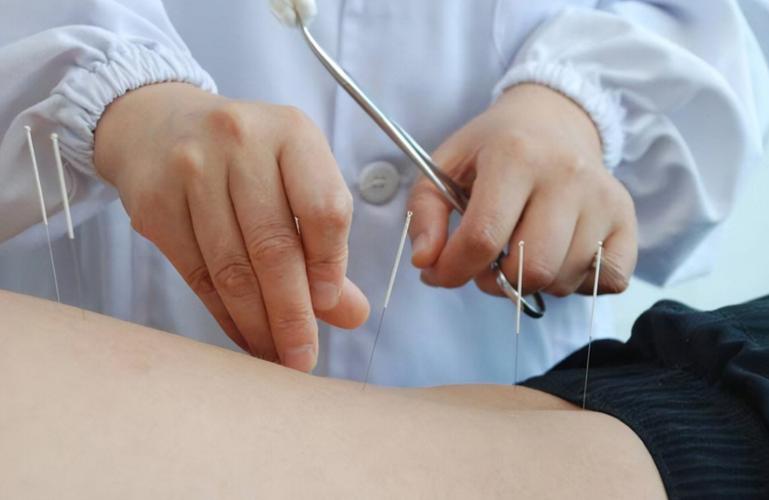 针灸可以治疗白内障