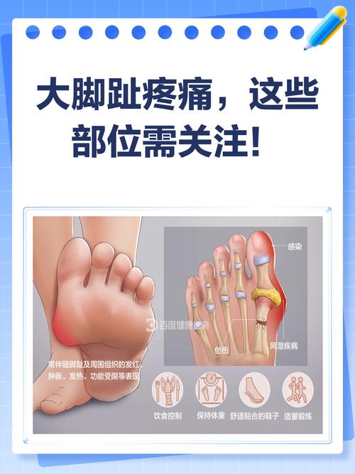 大脚趾发麻是痛风吗