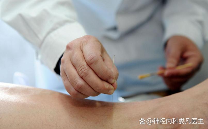 双下肢水肿针灸治疗