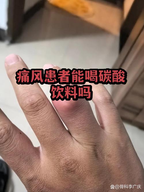 痛风能喝炭酸饮料吗