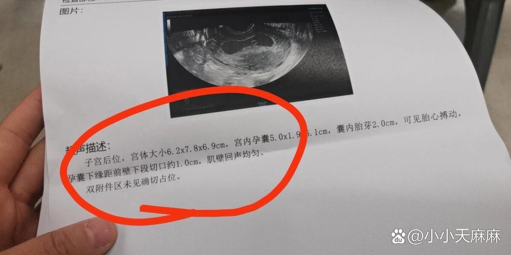 孕囊距切口的安全距离