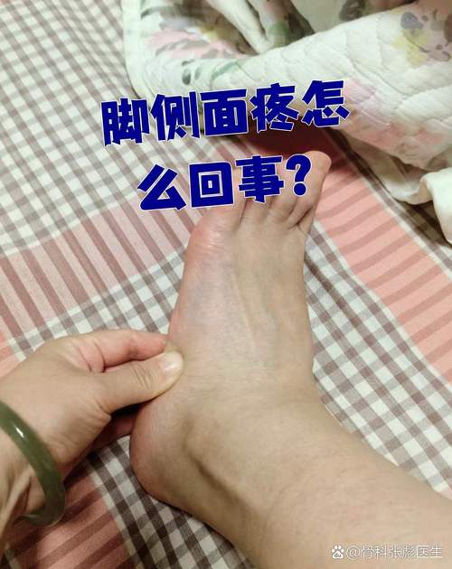 小腿侧面疼是痛风吗