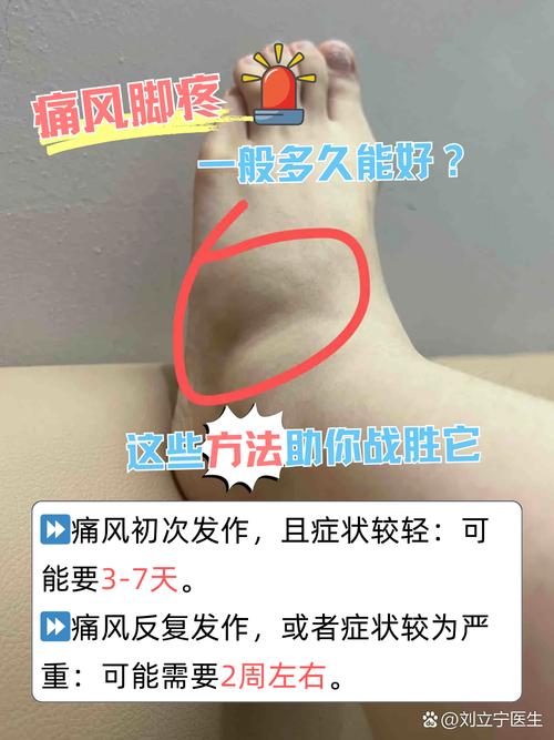 小腿侧面疼是痛风吗